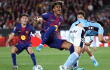 Lamine Yamal salió lesionado con Barcelona en partido frente al Celta de Vigo. 