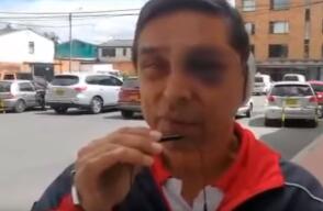 342107_Foto: BLU Radio