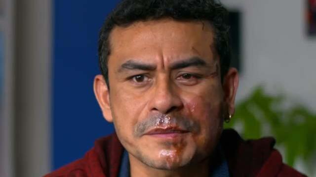 “¡Fuera de este país!”, le gritaron a peruano en EE. UU. antes de arrojarle ácido