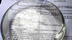 Francia prohibió varios tipos de implantes mamarios