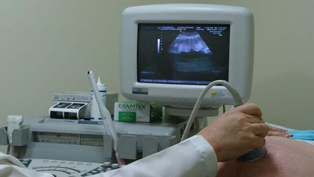 El sorprendente video de un bebé que juega en el vientre de su madre