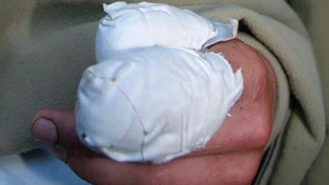 Algunos no aprenden: 35 quemados con pólvora deja noche de velitas en Colombia