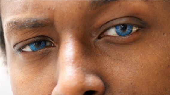 348636_BLU Radio. Ojos // Foto: Referencia AFP