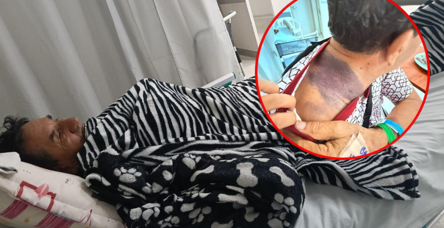 Adulto mayor soporta 4 días con fracturas por falta de una autorización de la Nueva EPS