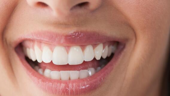 8544_La Kalle - trucos para tener los dientes blancos - Foto referencia Cimahub 8544_La Kalle - trucos para tener los dientes blancos - Foto referencia Cimahub