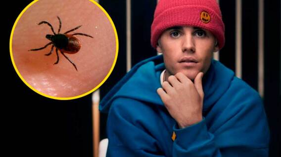 352402_Justin Bieber revela que padece la enfermedad de Lyme // Fotos: AFP 352402_Justin Bieber revela que padece la enfermedad de Lyme // Fotos: AFP