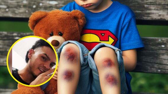 Niño de 3 años golpeado por orinarse en la cama