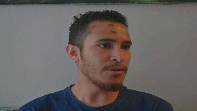 Dramático relato de joven al que le pasaron una tanqueta por encima durante protestas en Venezuela Dramático relato de joven al que le pasaron una tanqueta por encima durante protestas en Venezuela