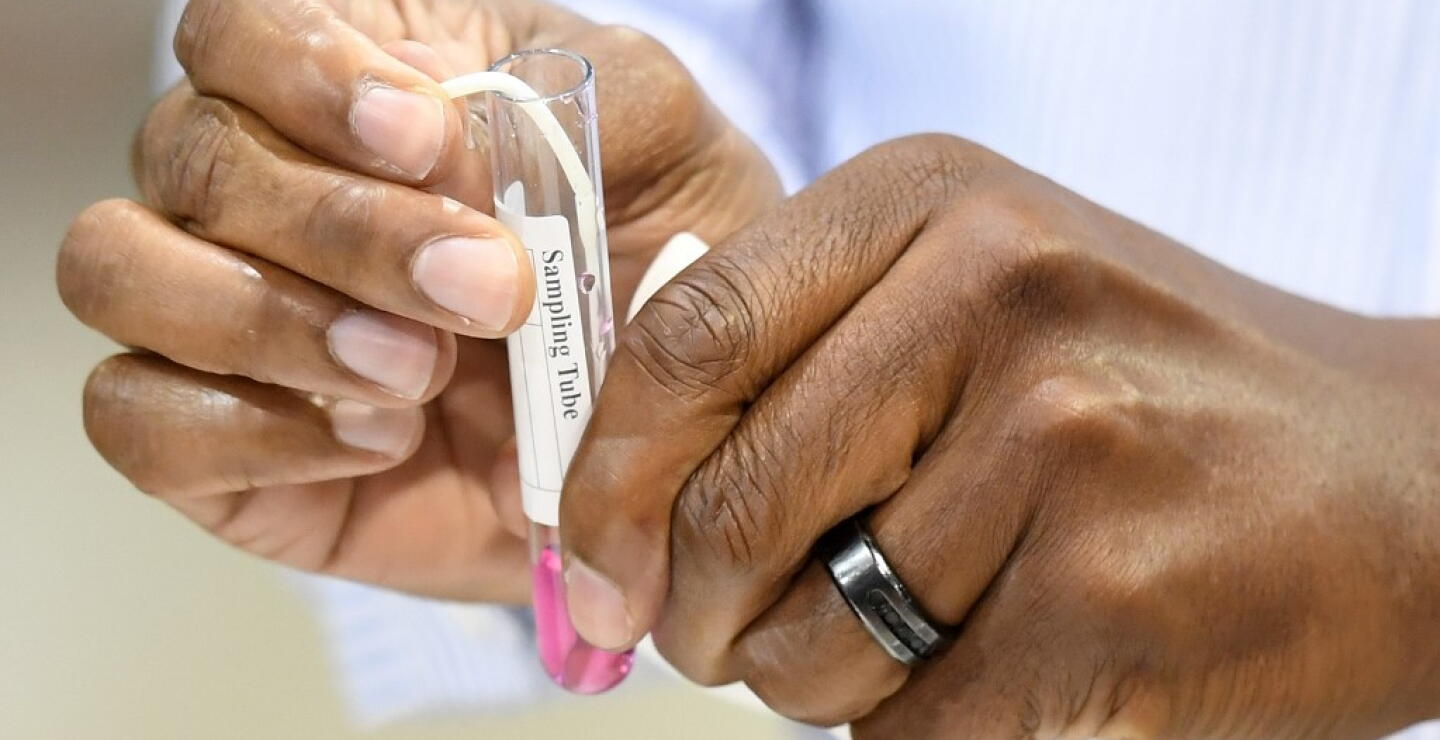 373158_Test coronavirus. Foto: AFP