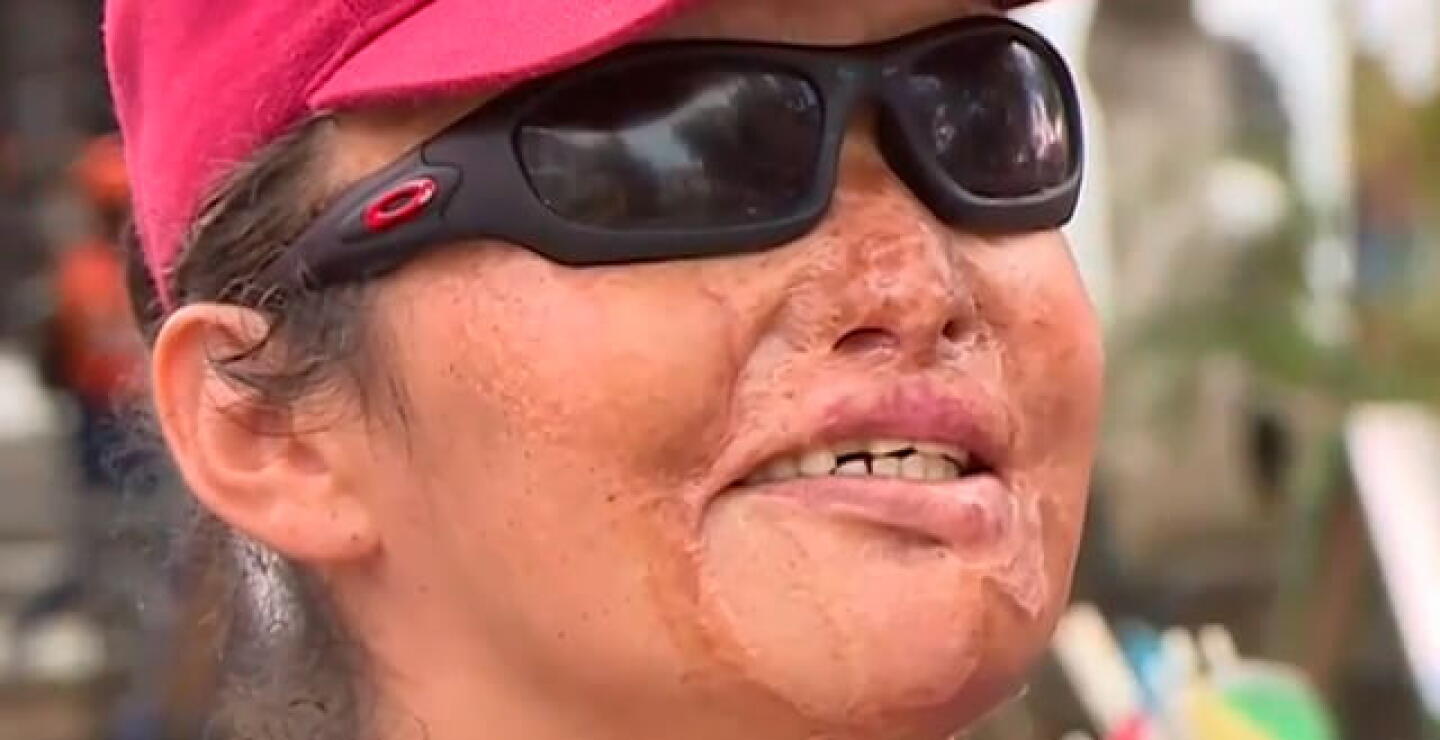 mujer-acido.jpg