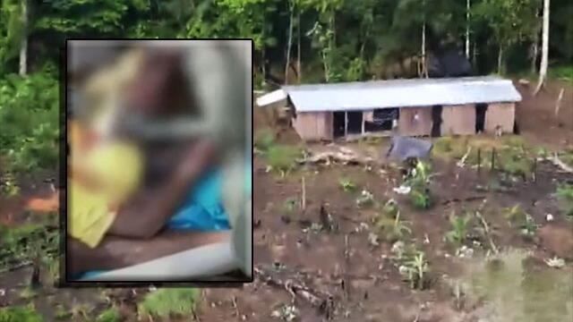 La tragedia de los cultivos ilícitos en Nariño y por la que a niño le tuvieron que amputar pierna