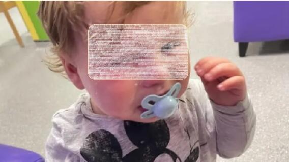 Bebé con pegante de uñas en los ojos.jpg Bebé con pegante de uñas en los ojos.jpg