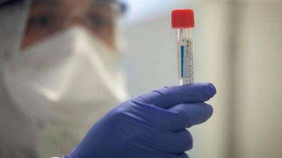 358856_BLU Radio. Prueba COVID-19 / Foto:Referencia