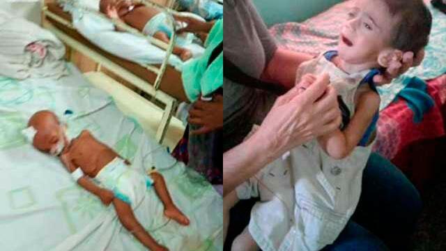 “Muchas veces nos acostamos sin comer”: lanzan SOS por niños que mueren de desnutrición en Venezuela