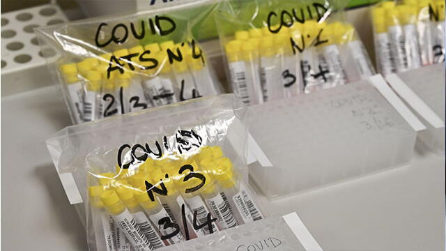 Coronavirus ya ha provocado más de 75.500 muertes en el mundo 