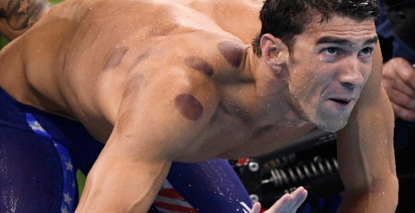 phelps-morados.jpg