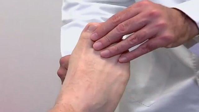 ¿Qué hacer si le sale un juanete?