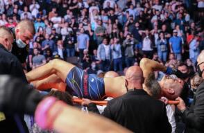 Chris Weidman se parte una pierna en el octágono de la UFC al lanzar una patada
