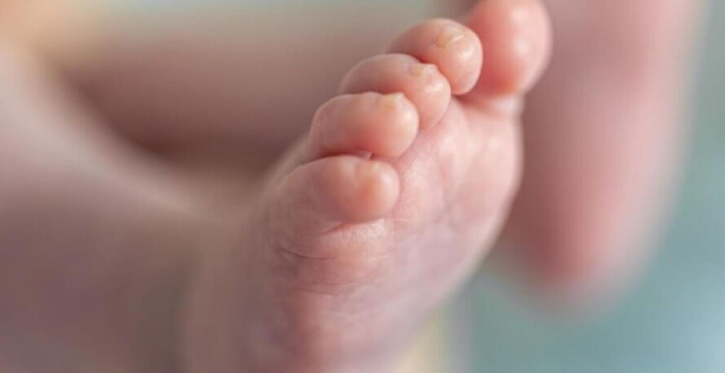 Bebé nació 'embarazada' de su gemela