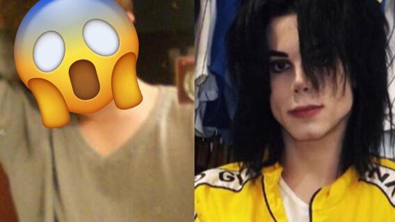 13917_Así lucía Leo Blanco, el joven que se sometió a cirugías para lucir como Michael Jackson - La Kalle - Instagram de @Leoblanco1 13917_Así lucía Leo Blanco, el joven que se sometió a cirugías para lucir como Michael Jackson - La Kalle - Instagram de @Leoblanco1