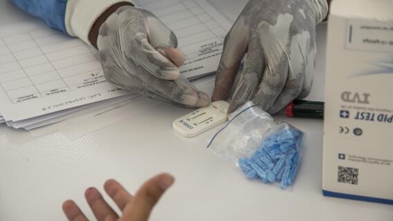 359340_Test coronavirus. Foto: AFP