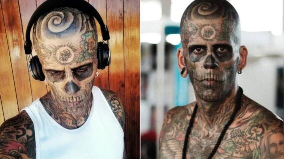 El hombre más tatuado de Brasil se quitó los tatuajes de la cara El hombre más tatuado de Brasil se quitó los tatuajes de la cara