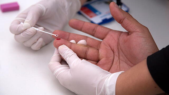 Día Internacional de la Lucha contra el Sida: autoridades alertan aumento en casos de contagio