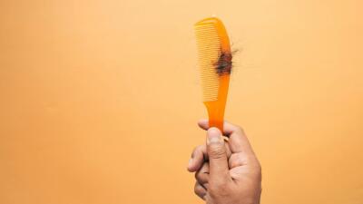 Alertan por producto de "cápsulas anti-alopecia” que puede ser perjudicial: esto dijo el Invima