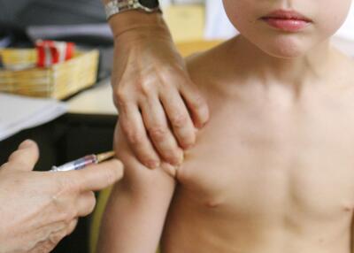 Sarampión / referencia 