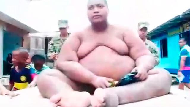 Luchan por salvar vida de joven de 22 años que pesa 400 kilos y sufre graves problemas de salud