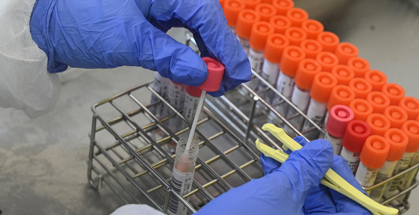 359188_Pruebas de coronavirus // Foto: AFP, imagen de referencia