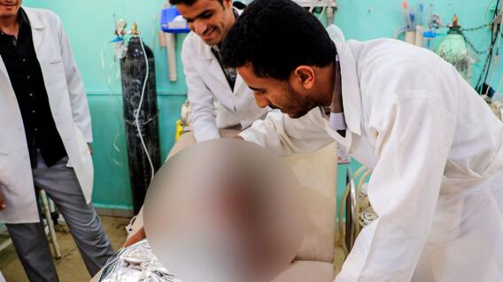 312832_BLU Radio. Atques Niño Yemen /Foto: AFP