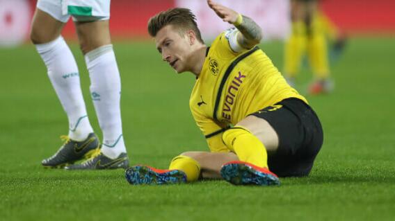 296815_Marco Reus, futbolista alemán. 296815_Marco Reus, futbolista alemán.