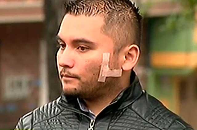 Policía intentó defender a mujer golpeada y esta le causó una grave herida
