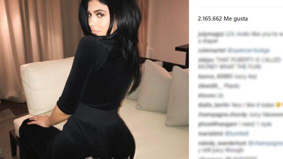 3307_La Kalle - Furor con la Pose Bambi - Foto: Instagram 3307_La Kalle - Furor con la Pose Bambi - Foto: Instagram