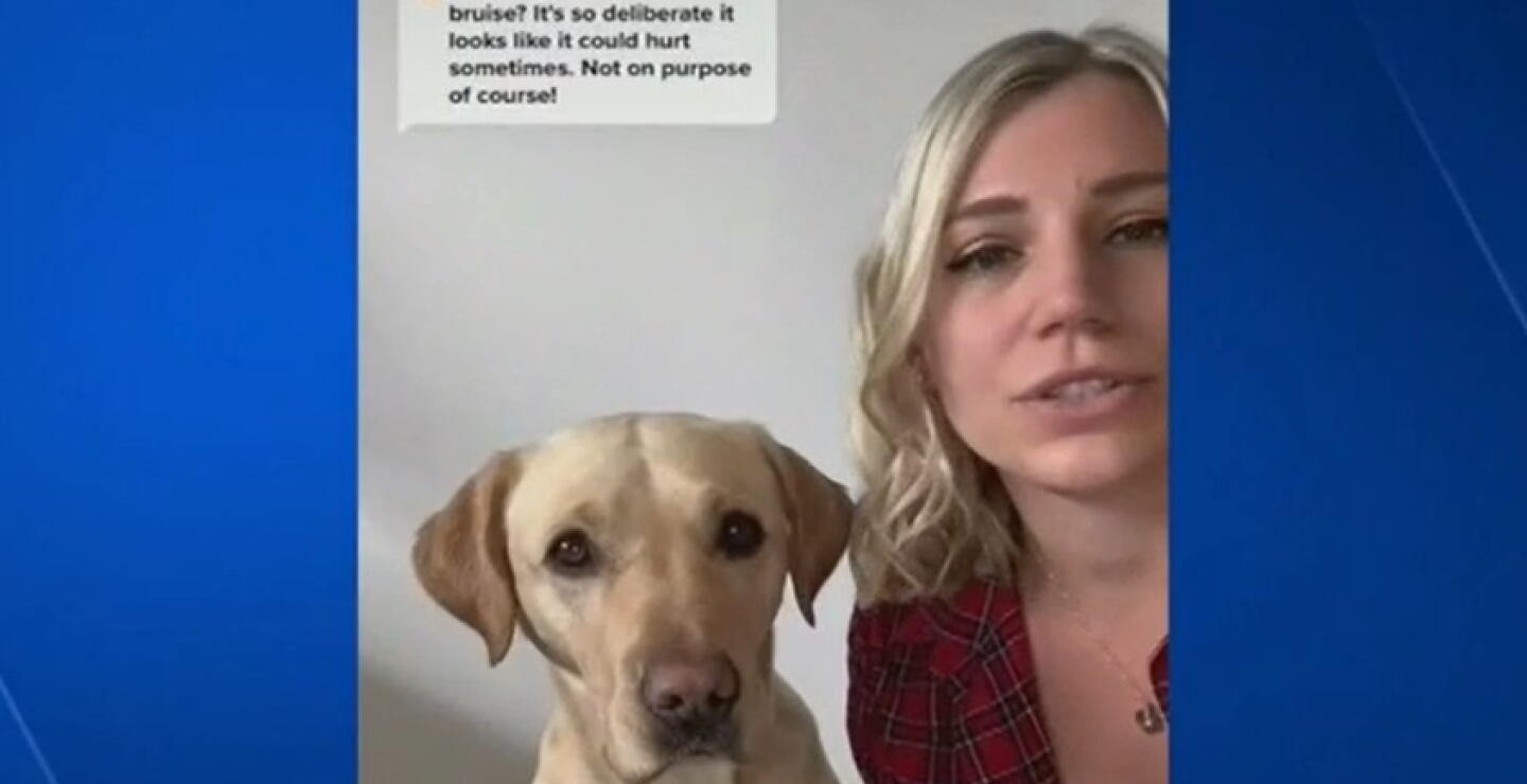 Una amistad que salva vidas: este perrito puede olfatear los niveles de azúcar de su ama diabética