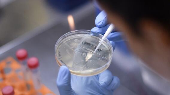 359247_Test coronavirus. Foto: AFP