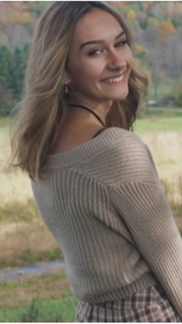 Joven que nació con malformación en su brazo asegura que internautas le aconsejan “amputárselo” 