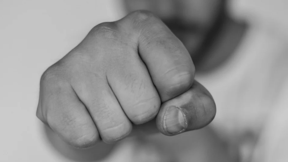 Hombre en compa tras ser brutalmente golpeado por un vecino Hombre en compa tras ser brutalmente golpeado por un vecino