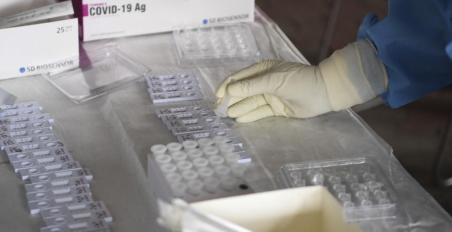 376099_Test coronavirus. Foto: AFP