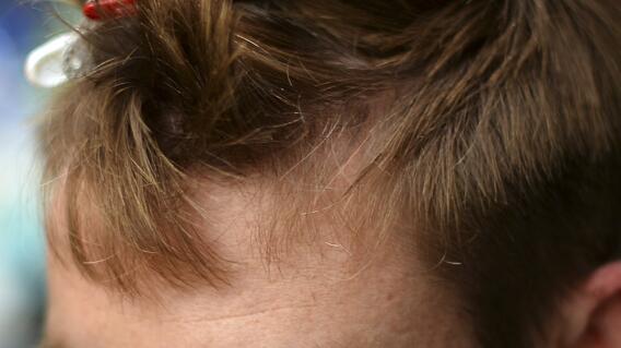 283634_Blu Radio. Pelo. Foto: Referencia AFP