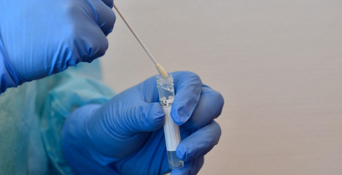 373403_Test coronavirus. Foto: AFP