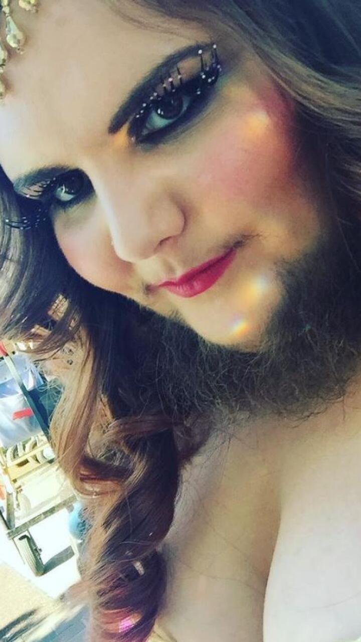 Mujer comparte su historia de amor propio tras aceptar el crecimiento de vello en su rostro