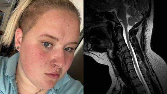 Le dijeron que tenía ansiedad, pero era grave condición Le dijeron que tenía ansiedad, pero era grave condición
