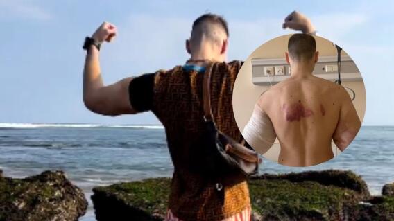 Popeye ruso podría perder sus brazos