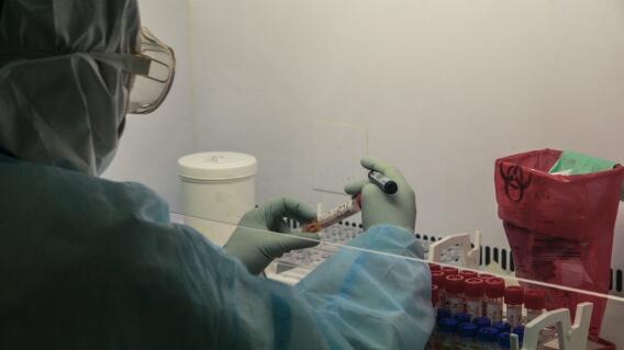 361621_Test coronavirus. Foto: AFP 361621_Test coronavirus. Foto: AFP