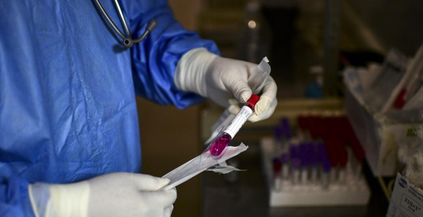 370098_Test coronavirus. Foto: AFP
