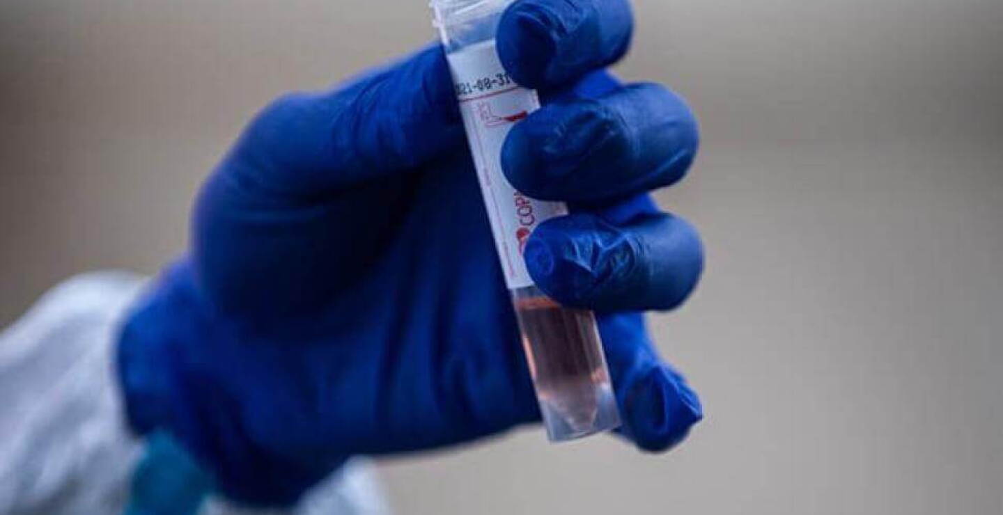 anticuerpo_coronavirus.jpg