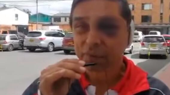 342107_Foto: BLU Radio