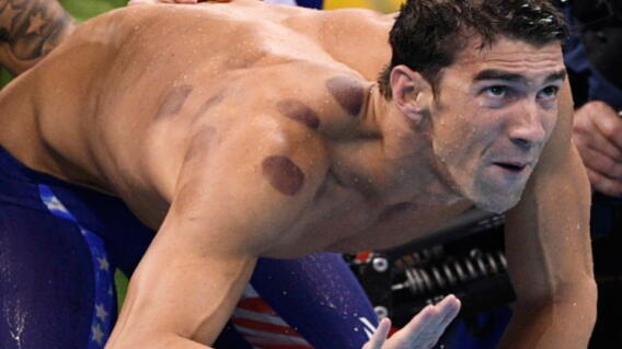 phelps-morados.jpg